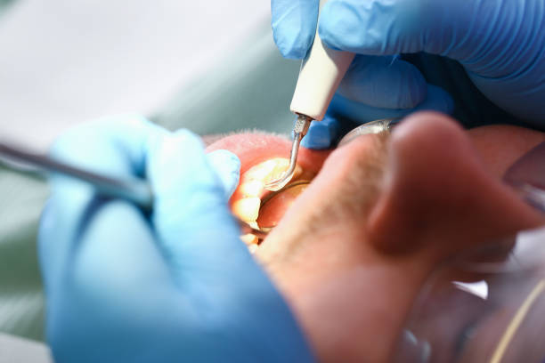 Best Emergency Dentist for Lost Fillings or Crowns in Sea Cliff, NY